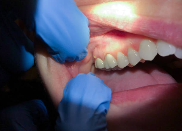 Best Orthodontic Emergency Dentist in Ardmore, AL