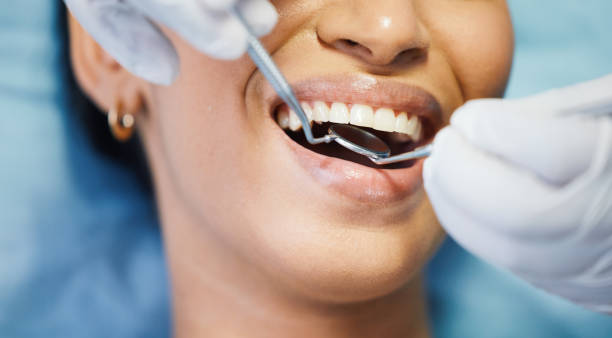 Best Emergency Dentist for Knocked-Out Tooth in Ardmore, AL